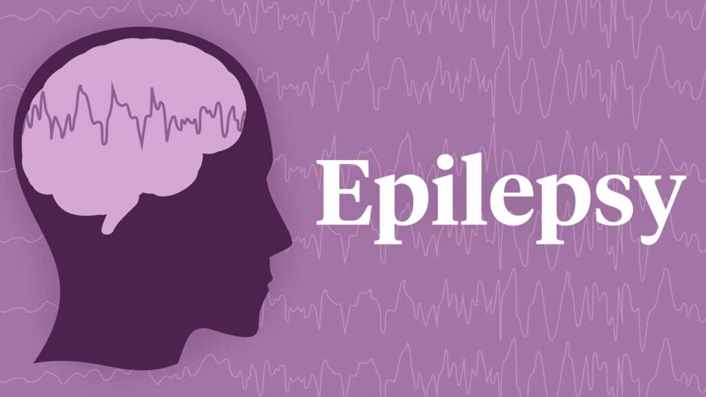 Epilepsy - Best psychiatrist in khambhalia - Mental health doctor in khambhalia